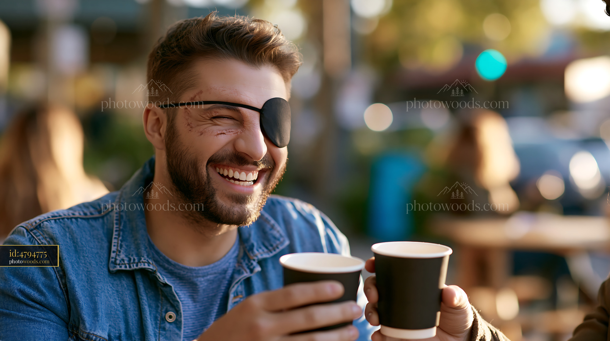 Laughing Young Man With Eye Patch Holding Coffee Cups Outdoors